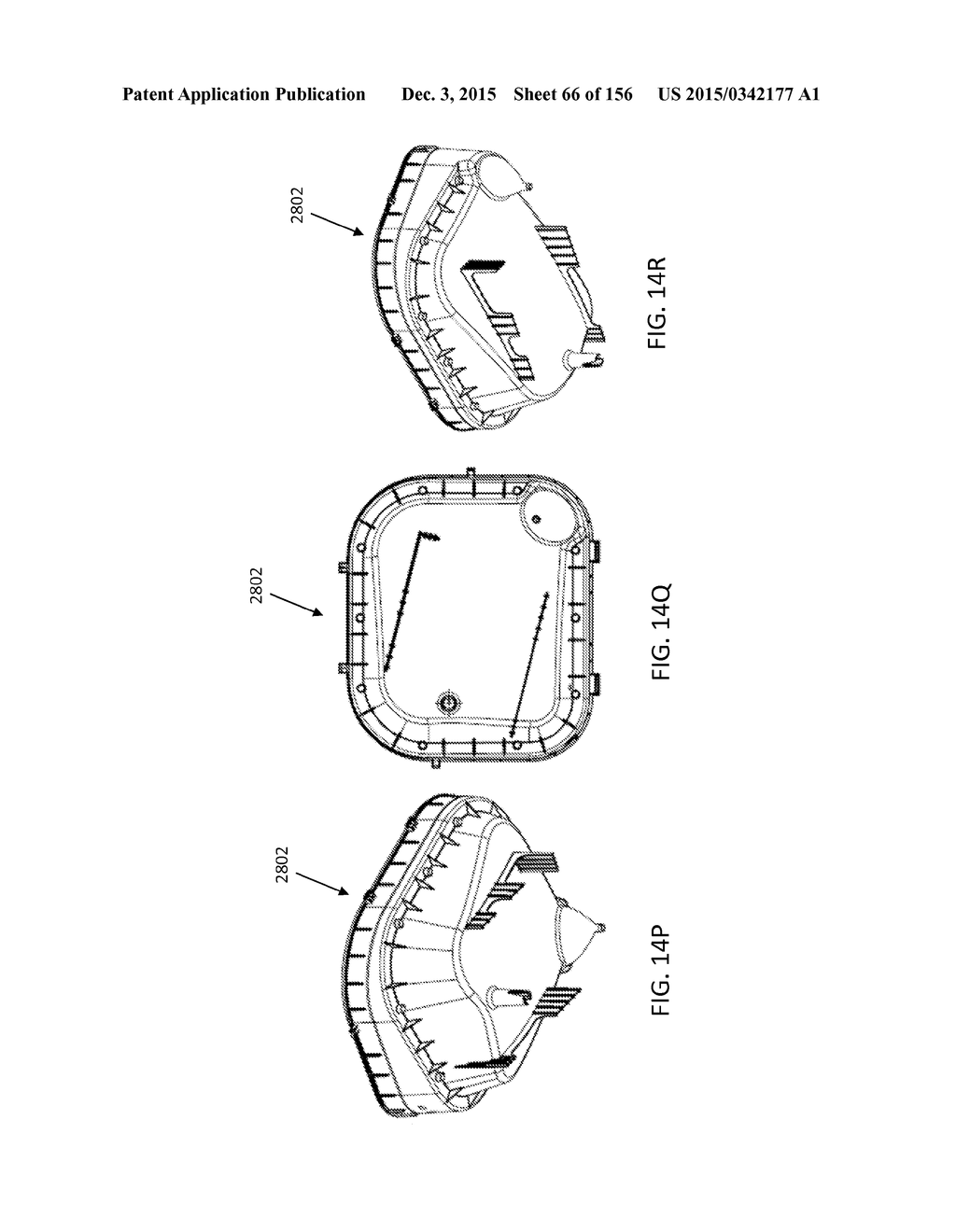 EX VIVO ORGAN CARE SYSTEM - diagram, schematic, and image 67