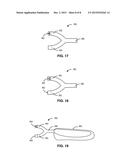 DECORATIVE SOCK STABILIZER diagram and image