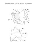 Baby Handling Device diagram and image