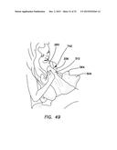 Baby Handling Device diagram and image