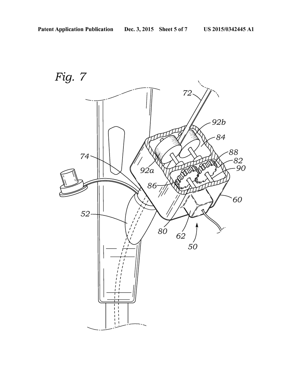 SYSTEM AND METHOD FOR RAPID SHUTTLING OF TOOLS THROUGH ENDOSCOPES - diagram, schematic, and image 06