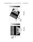 SYSTEMS AND METHODS FOR DETECTING AND MONITORING ARRHYTHMIAS USING THE PPG diagram and image