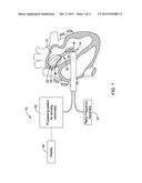 MEDICAL DEVICES FOR MAPPING CARDIAC TISSUE diagram and image