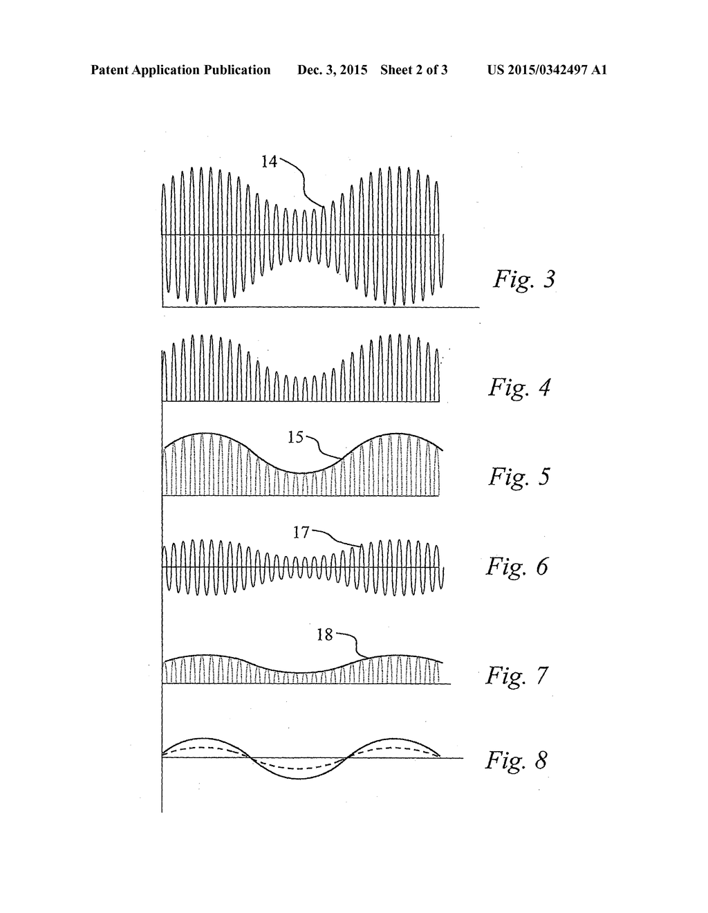 METHOD AND APPARATUS FOR ACQUIRING OF SIGNALS FOR ELECTRICAL IMPEDANCE - diagram, schematic, and image 03