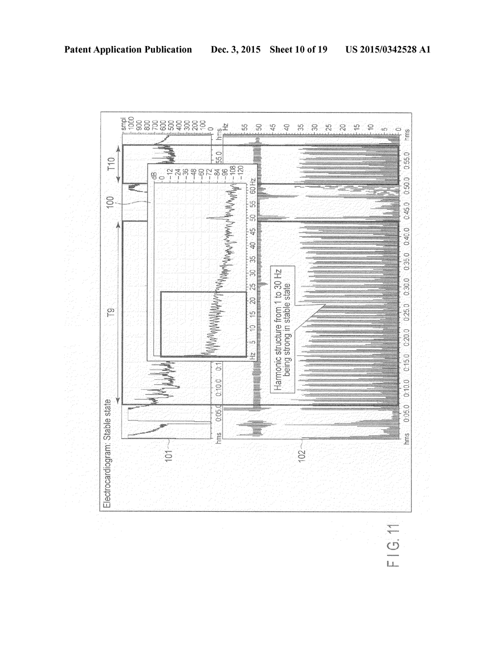 ELECTRONIC APPARATUS AND VITAL SIGN SIGNAL MEASURING METHOD - diagram, schematic, and image 11