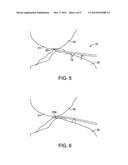 FORCE MEASURING JOINT DISTRACTION LEVER diagram and image