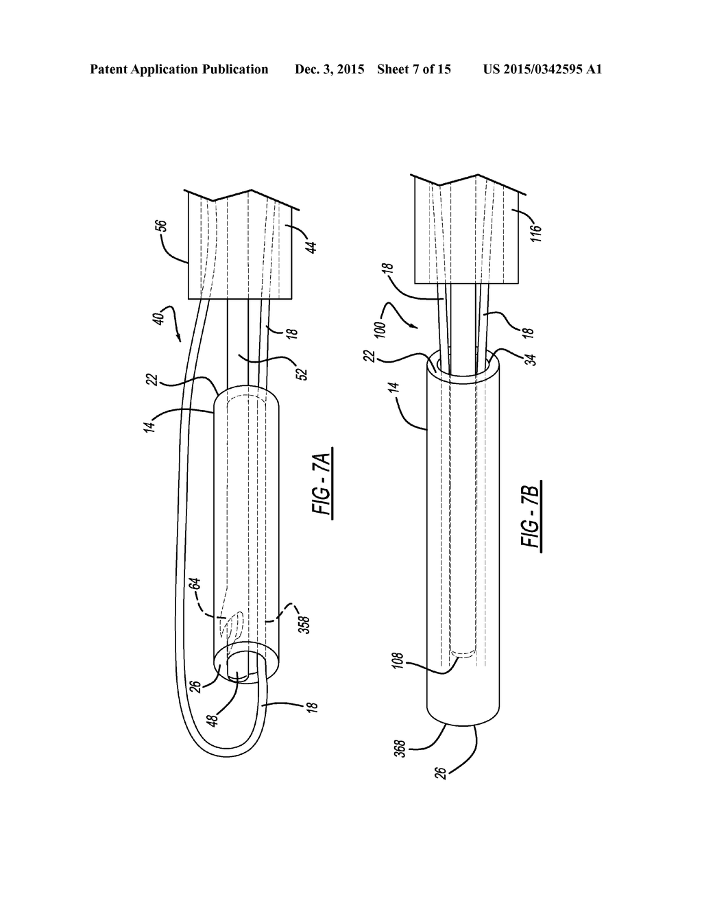 Insertion Tools and Method for Soft Anchor - diagram, schematic, and image 08