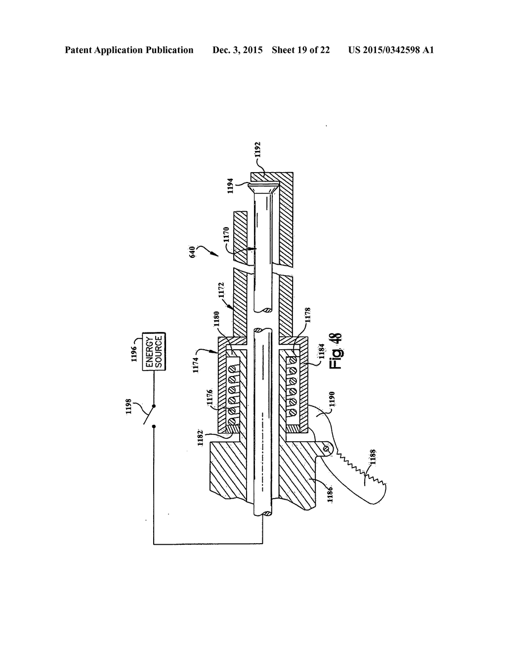 METHOD AND DEVICE FOR SECURING BODY TISSUE - diagram, schematic, and image 20