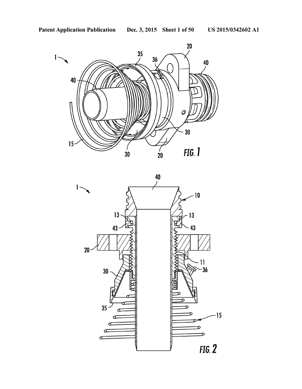 Systems and Methods for Percutaneous Access, Stabilization and Closure of     Organs - diagram, schematic, and image 02