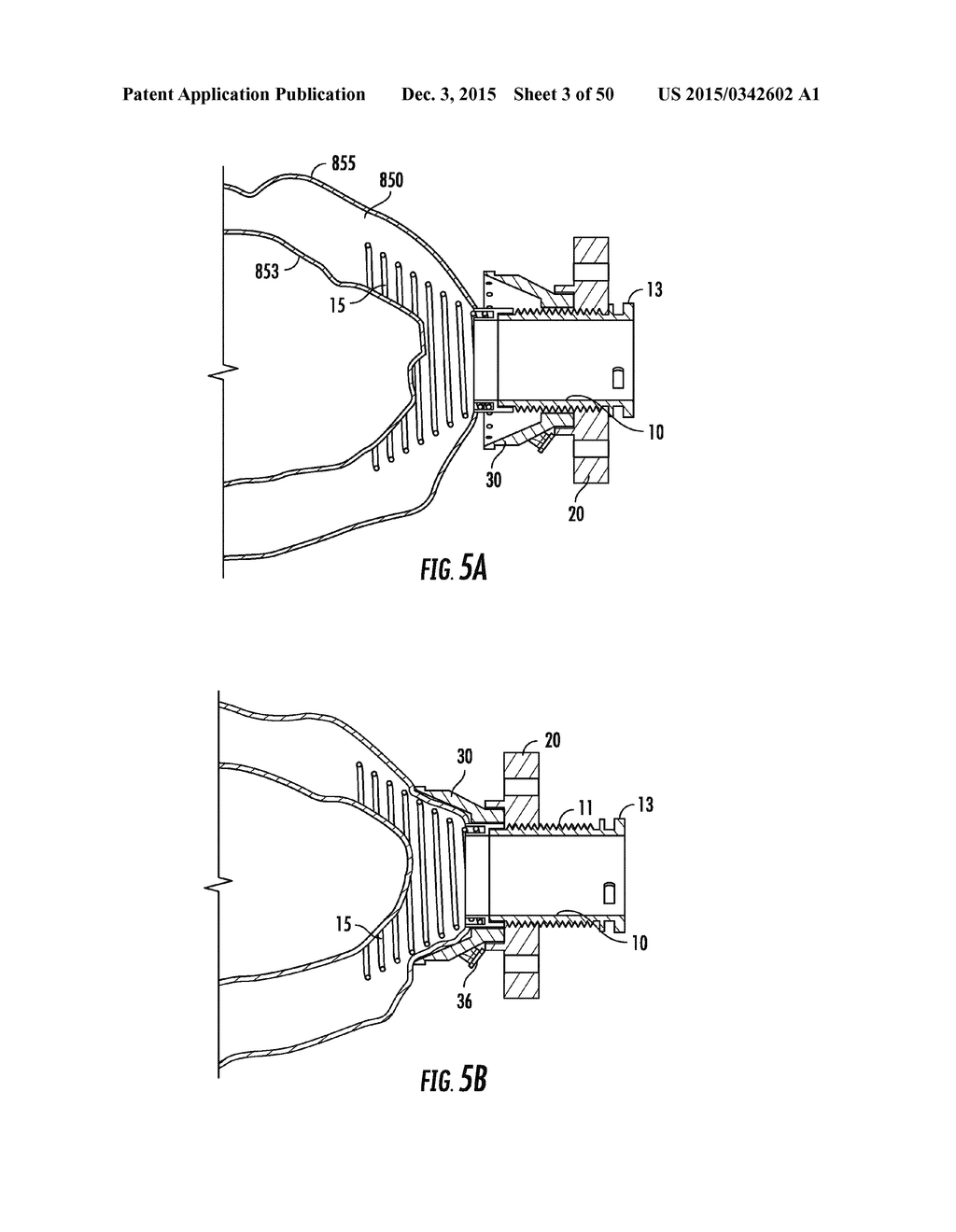 Systems and Methods for Percutaneous Access, Stabilization and Closure of     Organs - diagram, schematic, and image 04