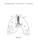 MEDICAL DEVICES AND METHODS FOR LUNG VOLUME REDUCTION diagram and image