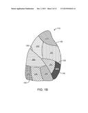 MEDICAL DEVICES AND METHODS FOR LUNG VOLUME REDUCTION diagram and image