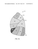 MEDICAL DEVICES AND METHODS FOR LUNG VOLUME REDUCTION diagram and image