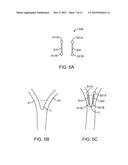 MEDICAL DEVICES AND METHODS FOR LUNG VOLUME REDUCTION diagram and image