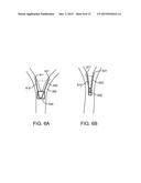 MEDICAL DEVICES AND METHODS FOR LUNG VOLUME REDUCTION diagram and image