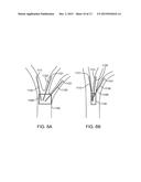 MEDICAL DEVICES AND METHODS FOR LUNG VOLUME REDUCTION diagram and image