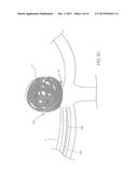 DEVICES AND METHODS FOR THE TREATMENT OF VASCULAR DEFECTS diagram and image