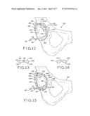 PATIENT-SPECIFIC INSTRUMENTS FOR TOTAL HIP ARTHROPLASTY diagram and image