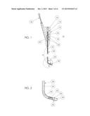 TISSUE REMOVAL DEVICE diagram and image