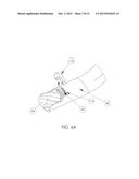 TISSUE REMOVAL DEVICE diagram and image