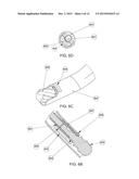 TISSUE REMOVAL DEVICE diagram and image