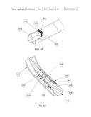 TISSUE REMOVAL DEVICE diagram and image