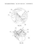 TISSUE REMOVAL DEVICE diagram and image