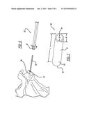 Patient-Specific Glenoid Depth Control diagram and image