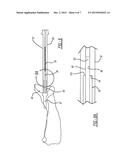 Patient-Specific Glenoid Depth Control diagram and image