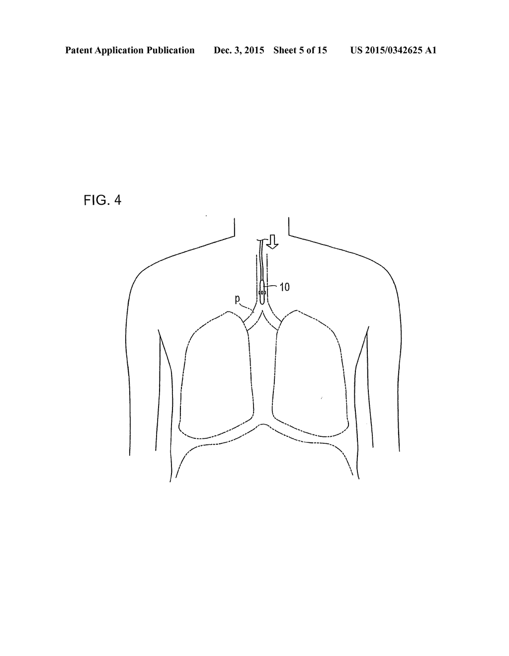 MEDICAL INSTRUMENT - diagram, schematic, and image 06