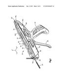 BONE FIXATION ASSEMBLY diagram and image