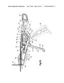 BONE FIXATION ASSEMBLY diagram and image