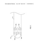 DOUBLE MICRO-ELECTRODE CATHETER diagram and image