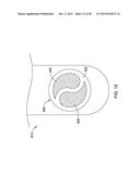 DOUBLE MICRO-ELECTRODE CATHETER diagram and image