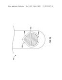 DOUBLE MICRO-ELECTRODE CATHETER diagram and image