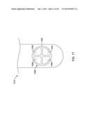 DOUBLE MICRO-ELECTRODE CATHETER diagram and image