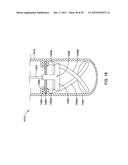 DOUBLE MICRO-ELECTRODE CATHETER diagram and image