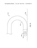 DOUBLE MICRO-ELECTRODE CATHETER diagram and image