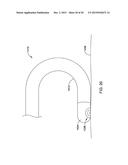 DOUBLE MICRO-ELECTRODE CATHETER diagram and image