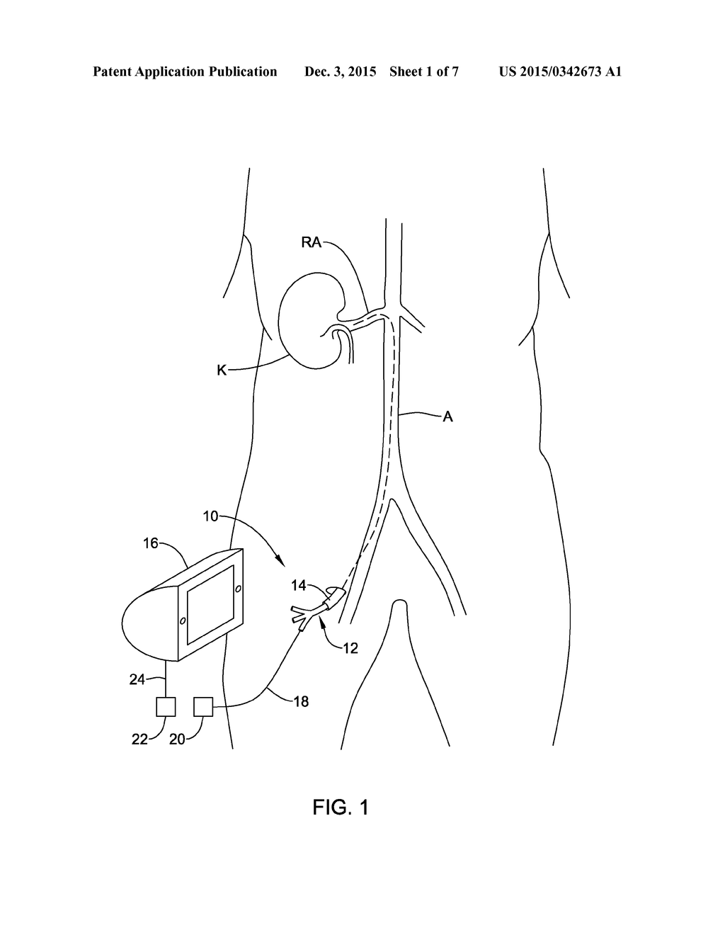 NERVE MODULATION DEVICES WITH COOLING CAPABILITIES - diagram, schematic, and image 02