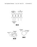 METHODS AND APPARATUS FOR INTRODUCING TUMESCENT FLUID TO BODY TISSUE diagram and image