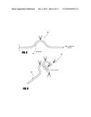 METHODS AND APPARATUS FOR INTRODUCING TUMESCENT FLUID TO BODY TISSUE diagram and image