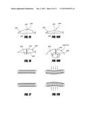 METHODS AND APPARATUS FOR INTRODUCING TUMESCENT FLUID TO BODY TISSUE diagram and image