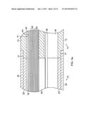 CATHETER WITH MULTIPLE ELECTRODE ASSEMBLIES FOR USE AT OR NEAR TUBULAR     REGIONS OF THE HEART diagram and image