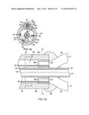 CATHETER WITH MULTIPLE ELECTRODE ASSEMBLIES FOR USE AT OR NEAR TUBULAR     REGIONS OF THE HEART diagram and image