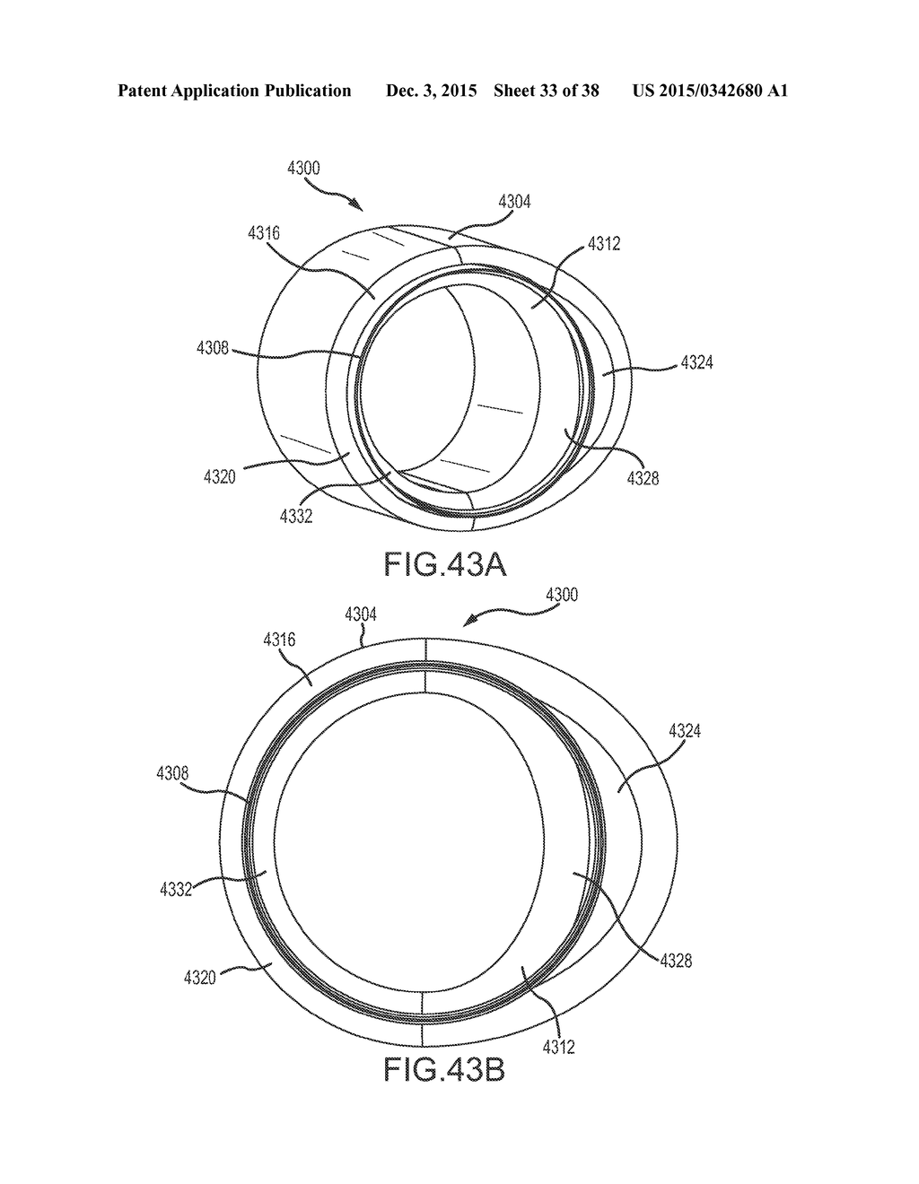 SURGICAL INSTRUMENT FOR REMOVING AN IMPLANTED OBJECT - diagram, schematic, and image 34