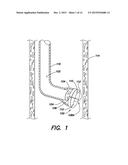 SYSTEMS AND METHOD FOR MICROACCESS TRANSESOPHAGEAL SURGERY diagram and image