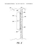 SYSTEMS AND METHOD FOR MICROACCESS TRANSESOPHAGEAL SURGERY diagram and image