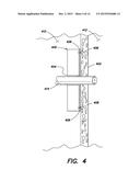 SYSTEMS AND METHOD FOR MICROACCESS TRANSESOPHAGEAL SURGERY diagram and image