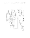 SURGICAL SYSTEM FOR AND A METHOD OF IDENTIFYING AN INCISION SITE diagram and image